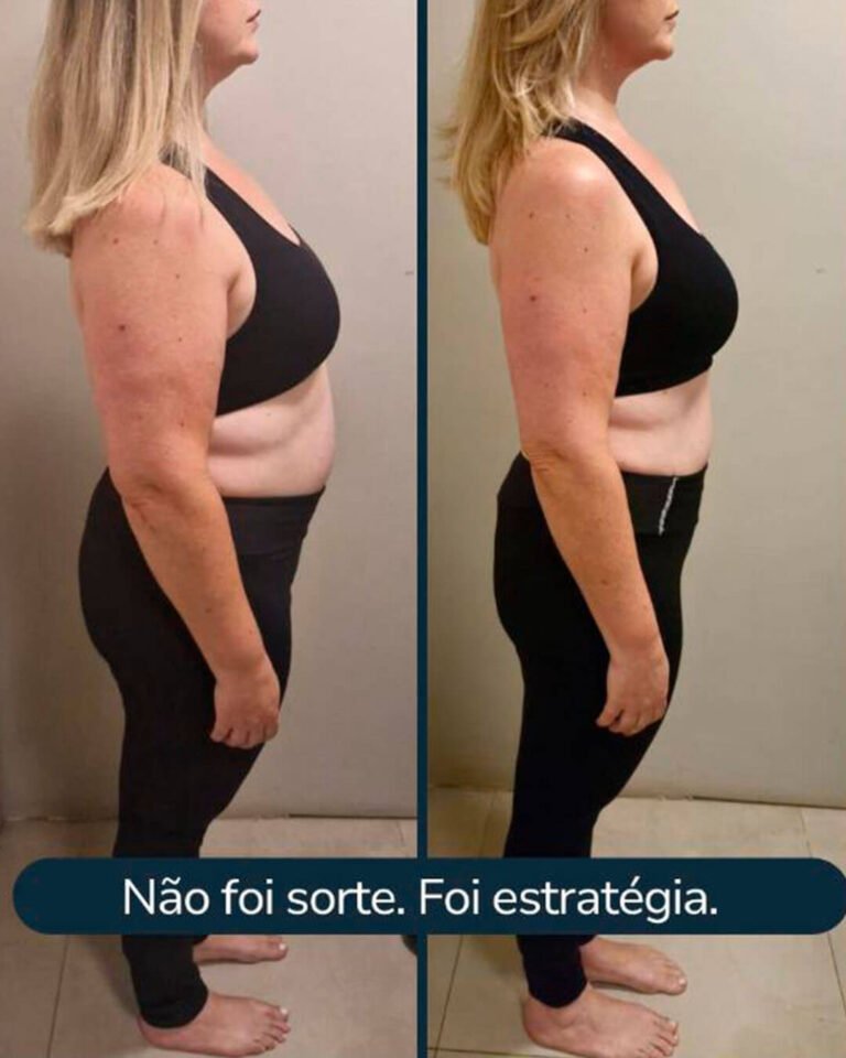 RESULTADO 2