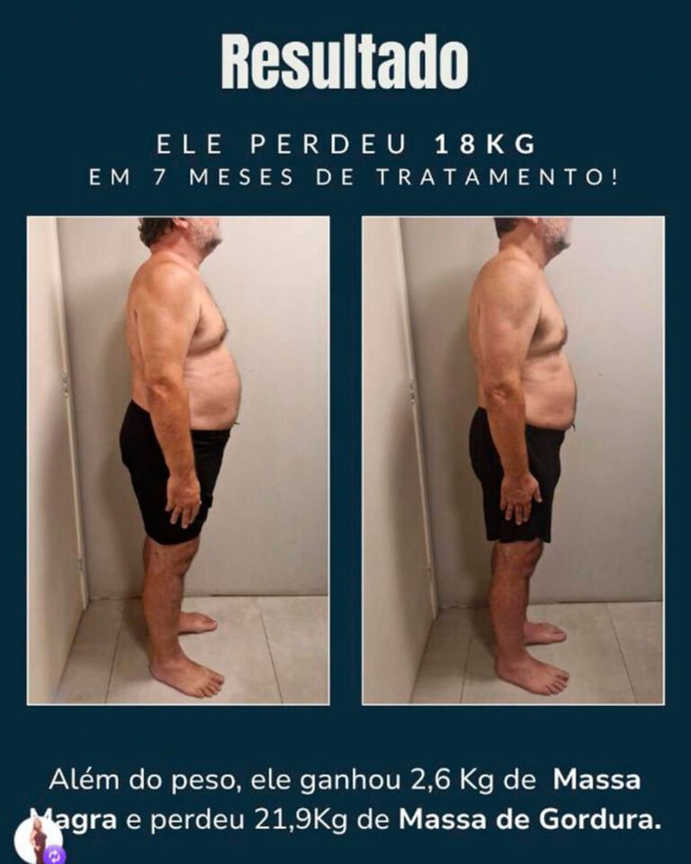 RESULTADO 5