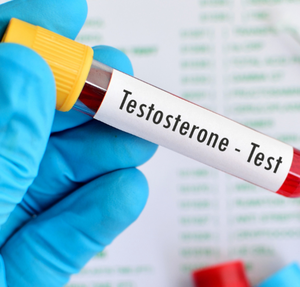 Reposição exame de testosterona para ganhar libido.